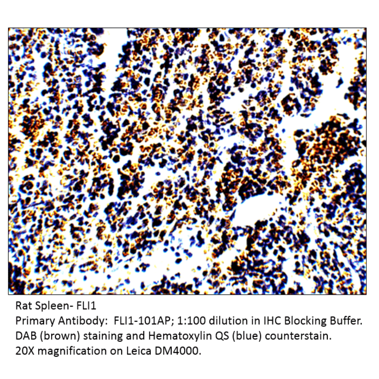 Anti-FLI1 Antibody from FabGennix (FLI-101AP) - Antibodies.com
