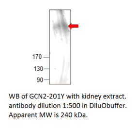 Anti-GCN2 Antibody from FabGennix (GCN2-201Y) - Antibodies.com