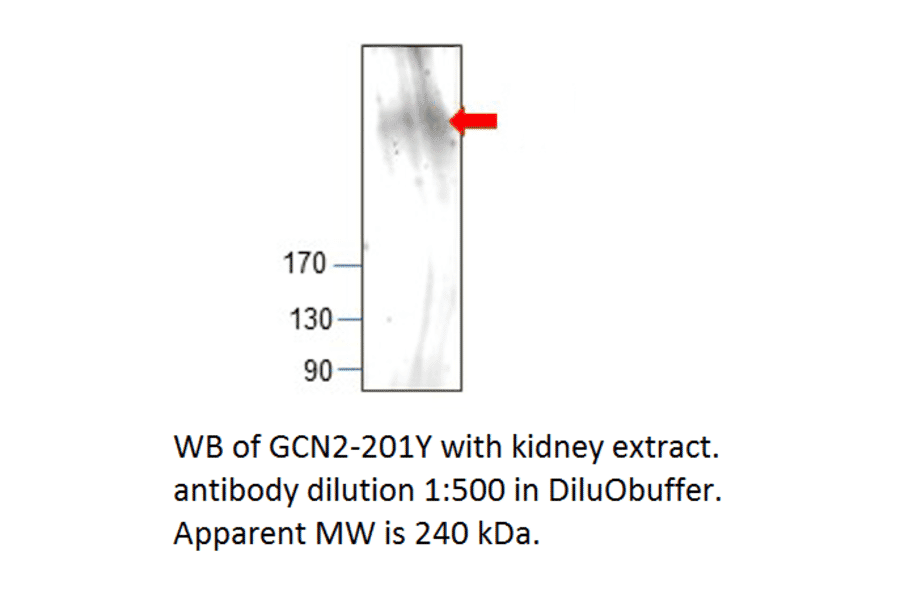 Anti-GCN2 Antibody from FabGennix (GCN2-201Y) - Antibodies.com