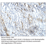 Anti-CMT Antibody from FabGennix (ICMT-101AP) - Antibodies.com