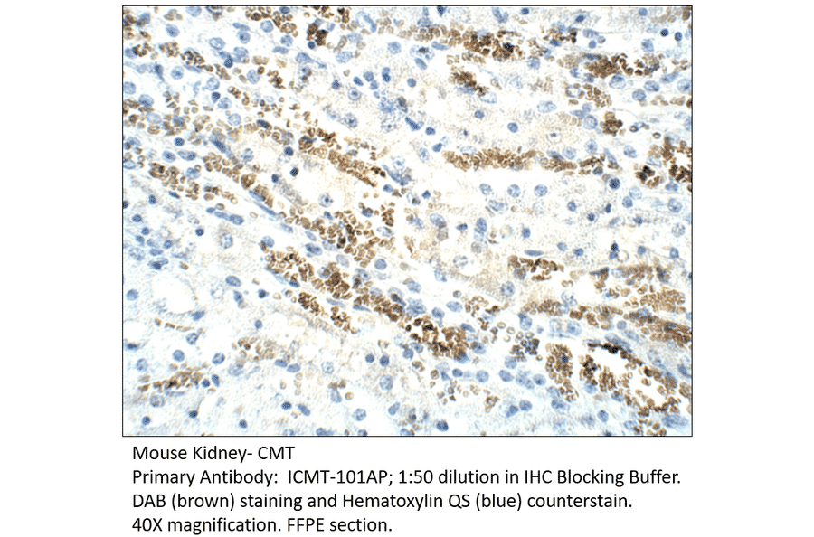 Anti-CMT Antibody from FabGennix (ICMT-101AP) - Antibodies.com