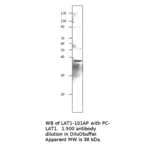 Anti-LAT Antibody from FabGennix (LAT1-101AP) - Antibodies.com