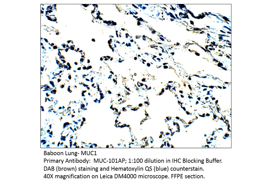 Anti-MUC1 Antibody from FabGennix (MUC-101AP) - Antibodies.com