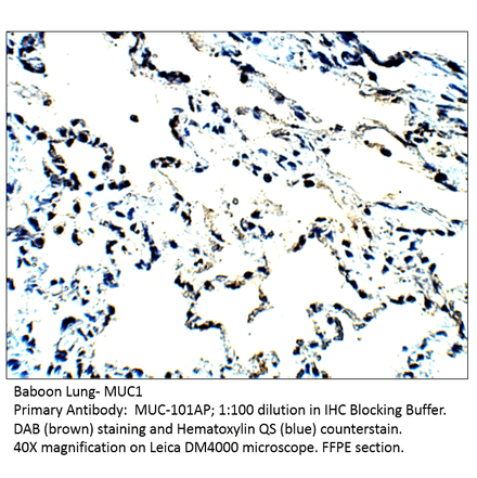 Anti-MUC1 Antibody from FabGennix (MUC-101AP) - Antibodies.com
