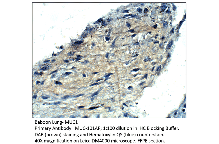 Anti-MUC1 Antibody from FabGennix (MUC-101AP) - Antibodies.com