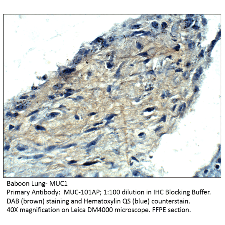 Anti-MUC1 Antibody from FabGennix (MUC-101AP) - Antibodies.com