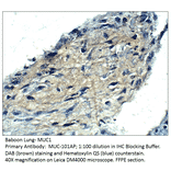 Anti-MUC1 Antibody from FabGennix (MUC-101AP) - Antibodies.com