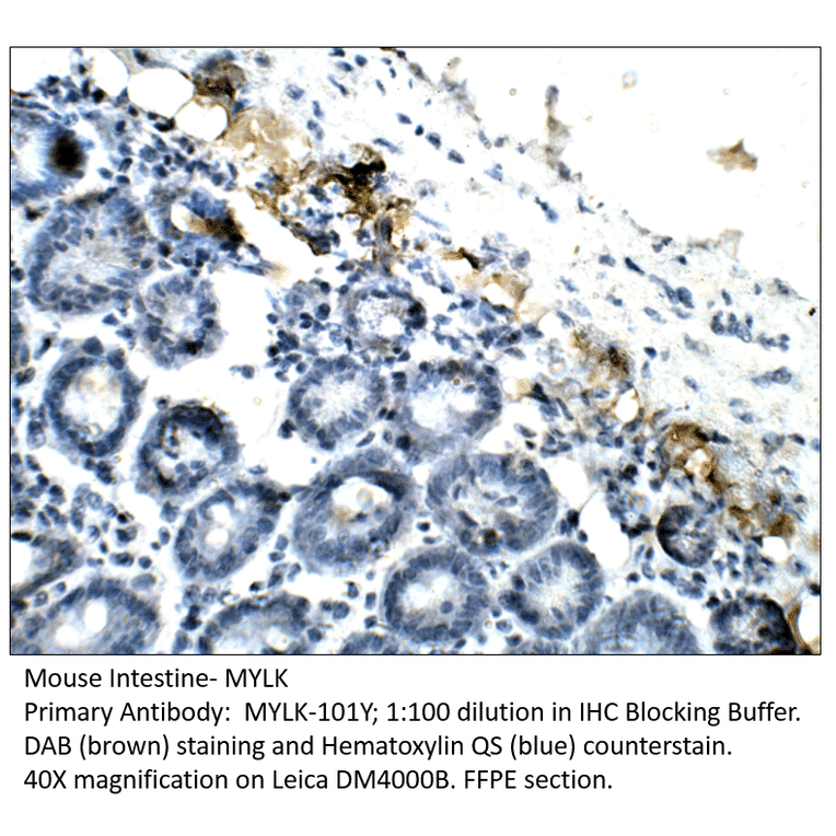 Anti-MYLK Antibody from FabGennix (MYLK-101Y) - Antibodies.com