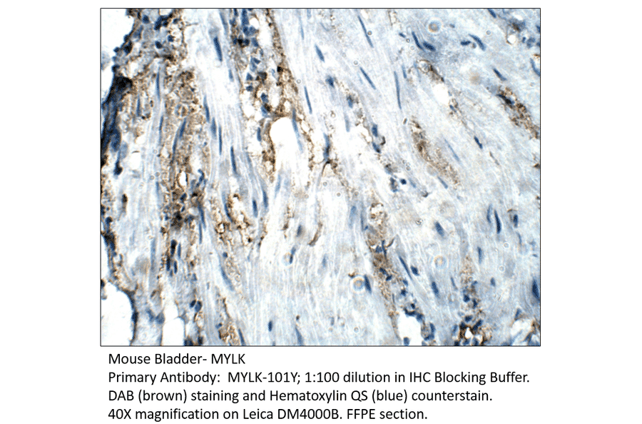 Anti-MYLK Antibody from FabGennix (MYLK-101Y) - Antibodies.com