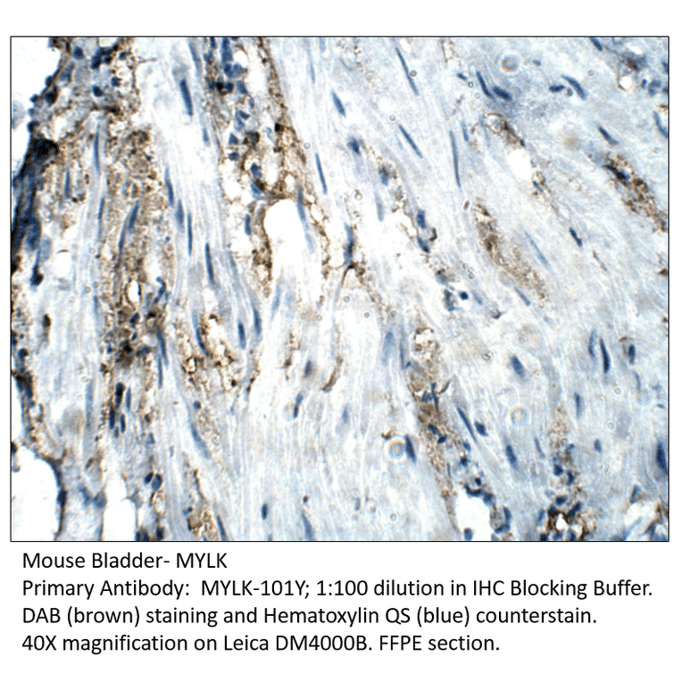 Anti-MYLK Antibody from FabGennix (MYLK-101Y) - Antibodies.com