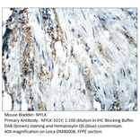 Anti-MYLK Antibody from FabGennix (MYLK-101Y) - Antibodies.com