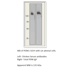 Anti-PERK Antibody from FabGennix (PERK-101Y) - Antibodies.com