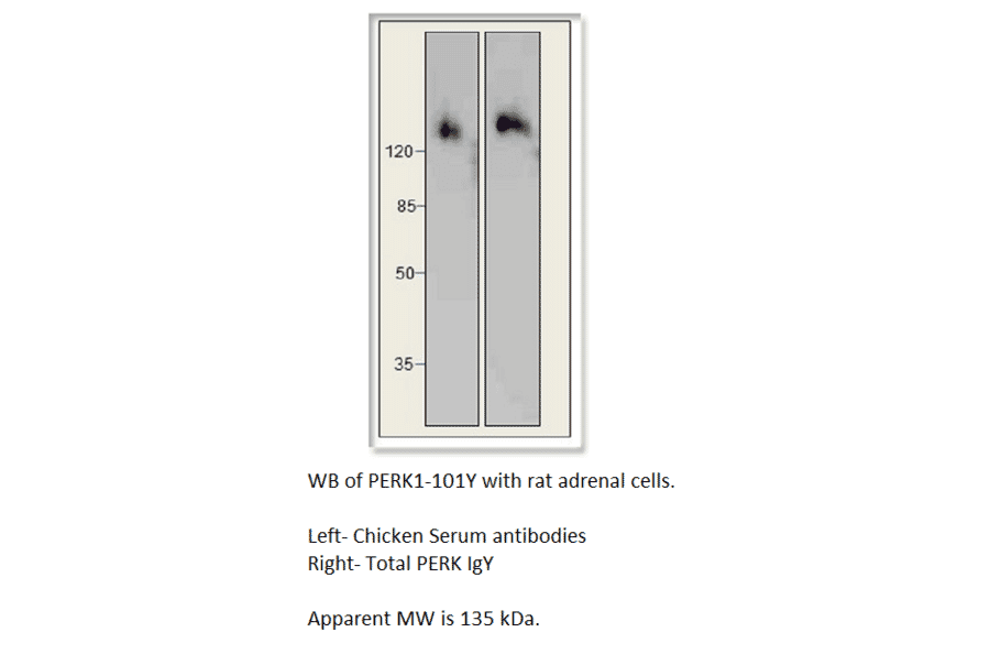 Anti-PERK Antibody from FabGennix (PERK-101Y) - Antibodies.com