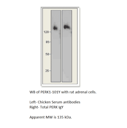 Anti-PERK Antibody from FabGennix (PERK-101Y) - Antibodies.com
