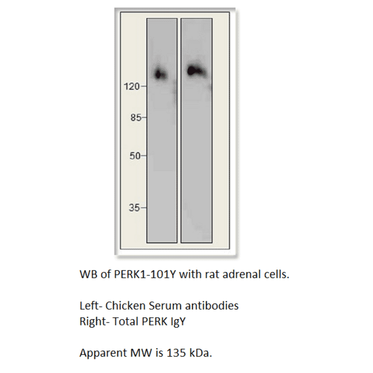 Anti-PERK Antibody from FabGennix (PERK-101Y) - Antibodies.com