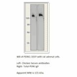 Anti-PERK Antibody from FabGennix (PERK-101Y) - Antibodies.com