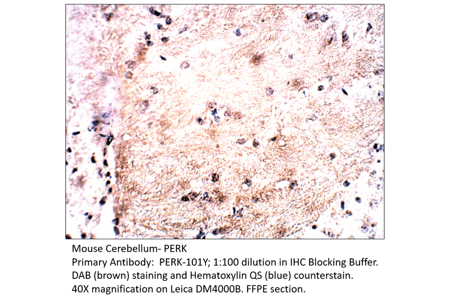 Anti-PERK Antibody from FabGennix (PERK-101Y) - Antibodies.com