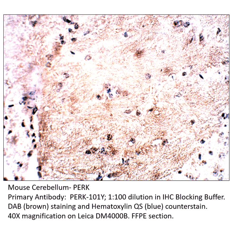 Anti-PERK Antibody from FabGennix (PERK-101Y) - Antibodies.com