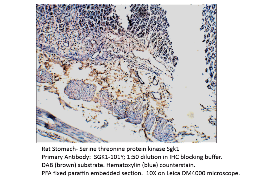 Anti-SGK1 Antibody from FabGennix (SGK1-101Y) - Antibodies.com