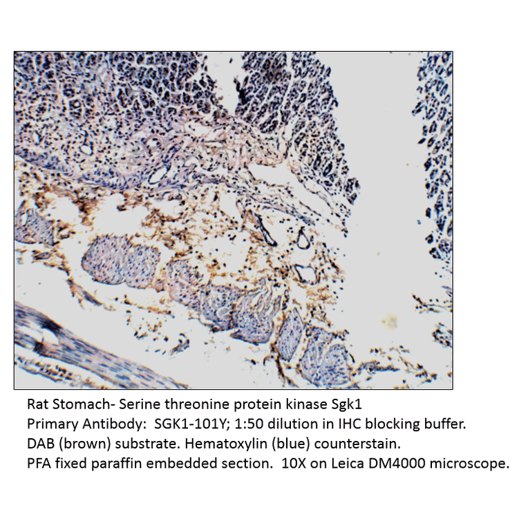Anti-SGK1 Antibody from FabGennix (SGK1-101Y) - Antibodies.com