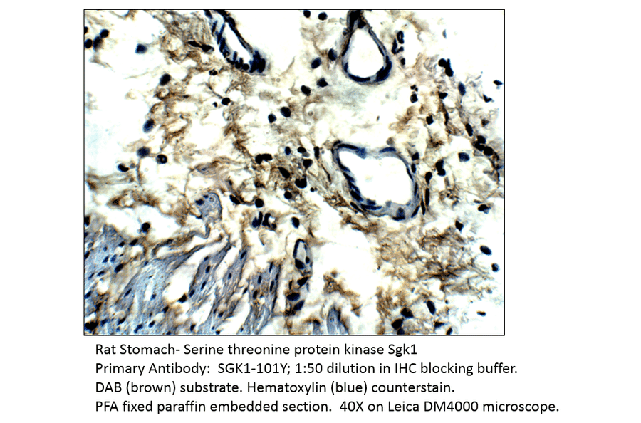 Anti-SGK1 Antibody from FabGennix (SGK1-101Y) - Antibodies.com