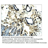 Anti-SGK1 Antibody from FabGennix (SGK1-101Y) - Antibodies.com