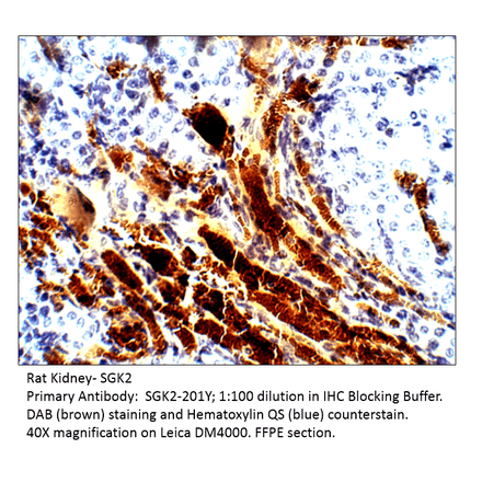 Anti-SGK2 Antibody from FabGennix (SGK2-201Y) - Antibodies.com