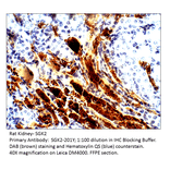 Anti-SGK2 Antibody from FabGennix (SGK2-201Y) - Antibodies.com