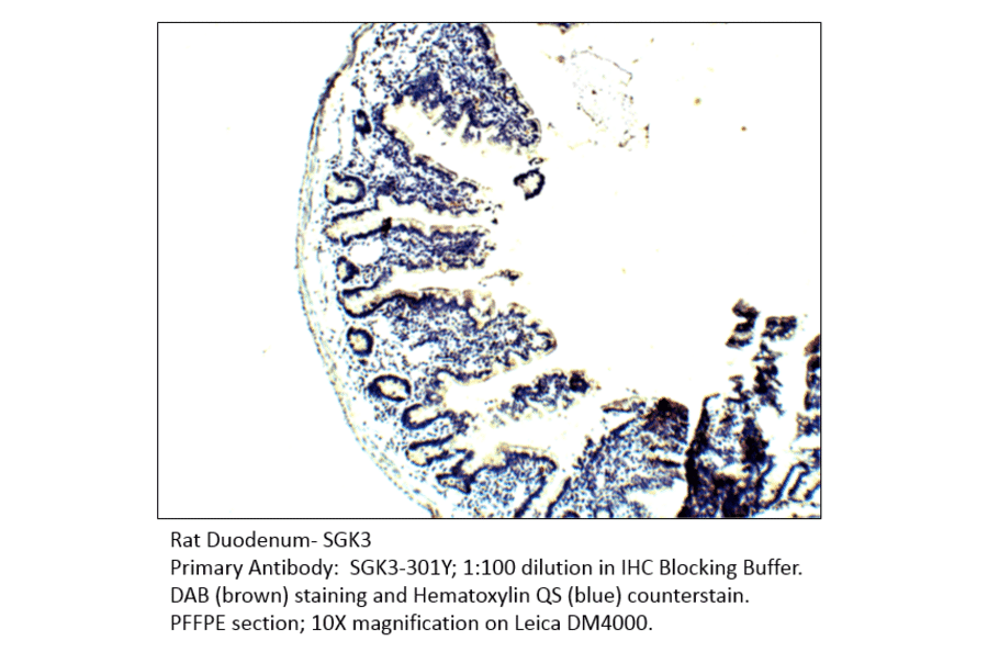Anti-SGK3 Antibody from FabGennix (SGK3-301Y) - Antibodies.com