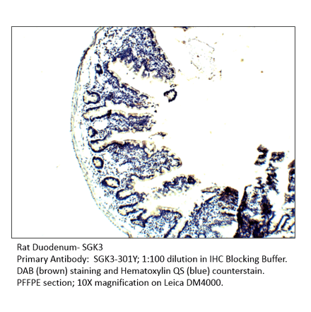 Anti-SGK3 Antibody from FabGennix (SGK3-301Y) - Antibodies.com