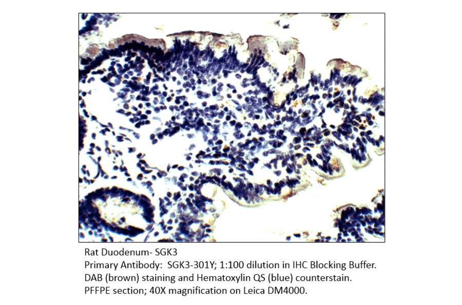 Anti-SGK3 Antibody from FabGennix (SGK3-301Y) - Antibodies.com