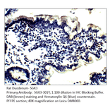 Anti-SGK3 Antibody from FabGennix (SGK3-301Y) - Antibodies.com