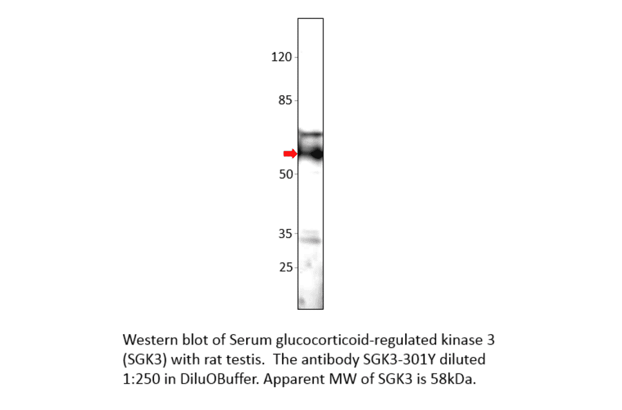 Anti-SGK3 Antibody from FabGennix (SGK3-301Y) - Antibodies.com