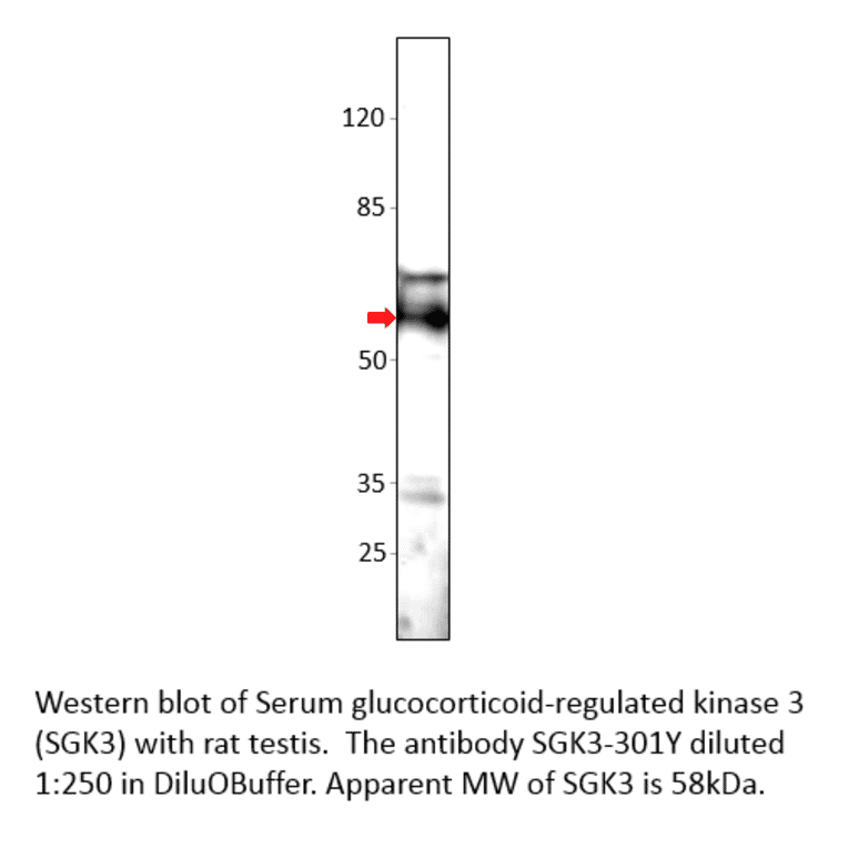 Anti-SGK3 Antibody from FabGennix (SGK3-301Y) - Antibodies.com