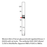 Anti-SGK3 Antibody from FabGennix (SGK3-301Y) - Antibodies.com