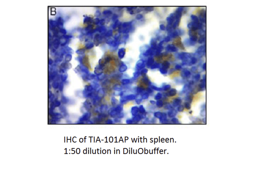 Anti-TIA1 Antibody from FabGennix (TIA-101AP) - Antibodies.com