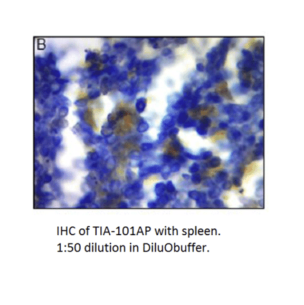 Anti-TIA1 Antibody from FabGennix (TIA-101AP) - Antibodies.com