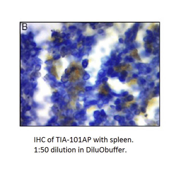 Anti-TIA1 Antibody from FabGennix (TIA-101AP) - Antibodies.com