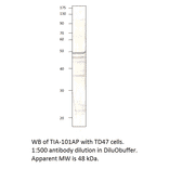 Anti-TIA1 Antibody from FabGennix (TIA-101AP) - Antibodies.com