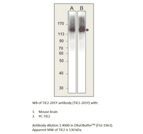 Anti-TIE2 Antibody from FabGennix (TIE2-201Y) - Antibodies.com