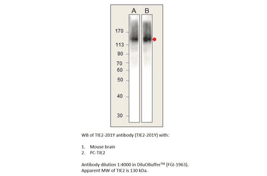 Anti-TIE2 Antibody from FabGennix (TIE2-201Y) - Antibodies.com