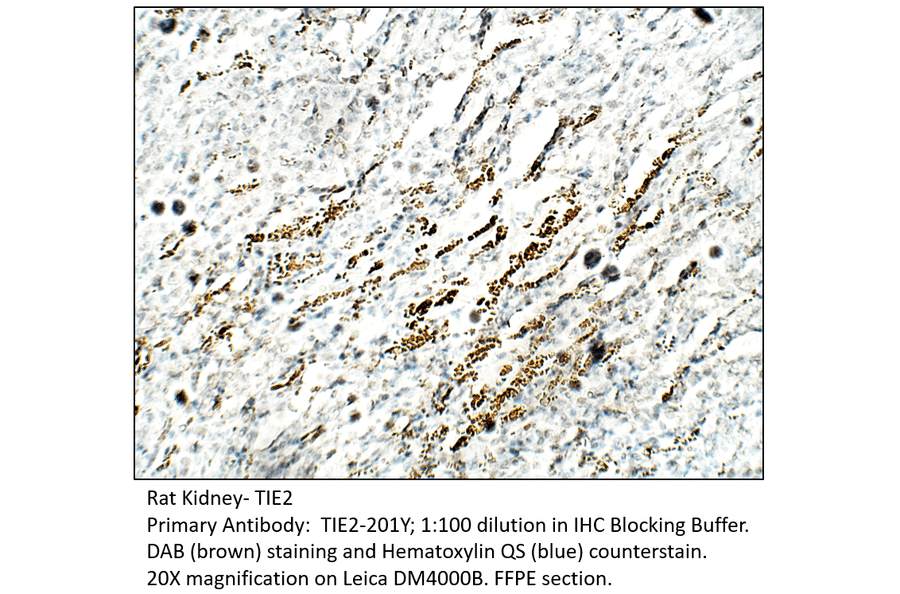Anti-TIE2 Antibody from FabGennix (TIE2-201Y) - Antibodies.com