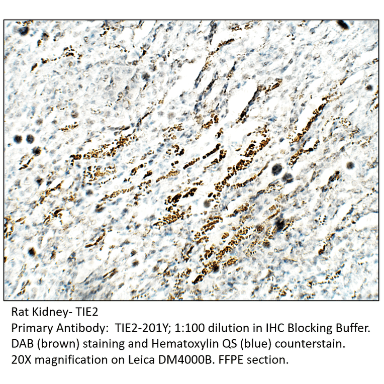 Anti-TIE2 Antibody from FabGennix (TIE2-201Y) - Antibodies.com