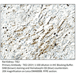 Anti-TIE2 Antibody from FabGennix (TIE2-201Y) - Antibodies.com