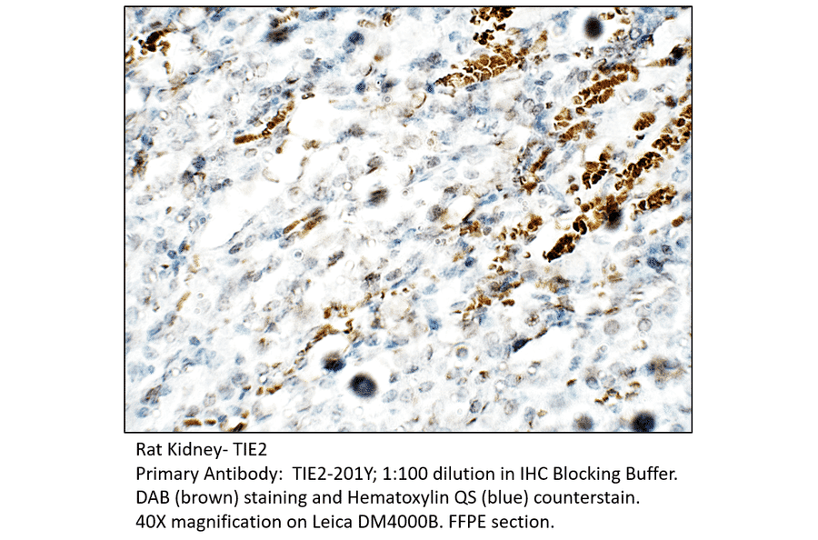 Anti-TIE2 Antibody from FabGennix (TIE2-201Y) - Antibodies.com