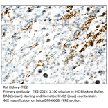 Anti-TIE2 Antibody from FabGennix (TIE2-201Y) - Antibodies.com