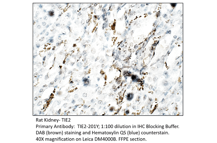 Anti-TIE2 Antibody from FabGennix (TIE2-201Y) - Antibodies.com