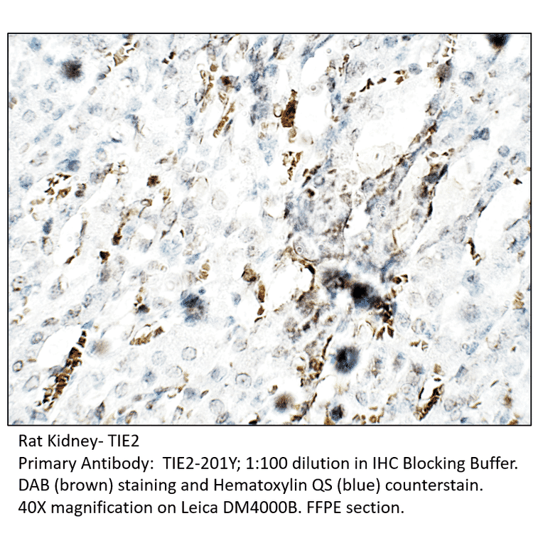 Anti-TIE2 Antibody from FabGennix (TIE2-201Y) - Antibodies.com