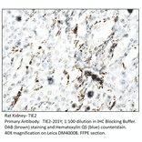 Anti-TIE2 Antibody from FabGennix (TIE2-201Y) - Antibodies.com