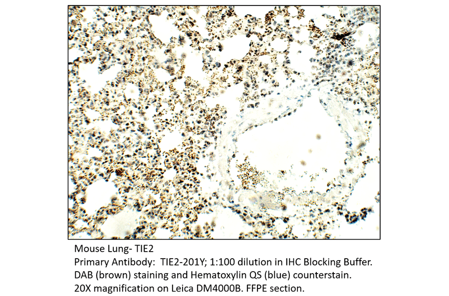 Anti-TIE2 Antibody from FabGennix (TIE2-201Y) - Antibodies.com